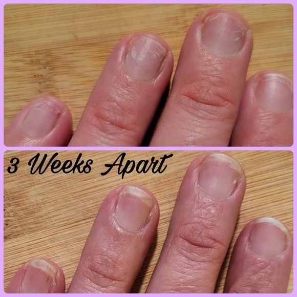 ✨ 93% absorbiton rate Liquid Collagen A. K. A. Liquid Gold 💫 - Picture 1 of 16